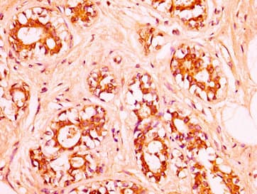 HIST1H1C Antibody
