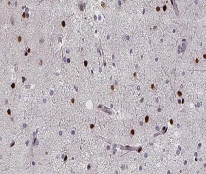 RPA2 / RFA2 / RPA34 Antibody (phospho-Thr21)