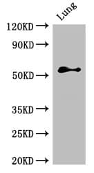 Polyclonal Rabbit anti-Human ALK-6 / BMPR1B Antibody (IHC, IF, WB)