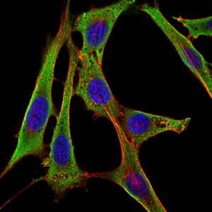 Monoclonal Mouse anti-Human FGG / Fibrinogen Gamma Antibody (clone 5A6, IF, WB)