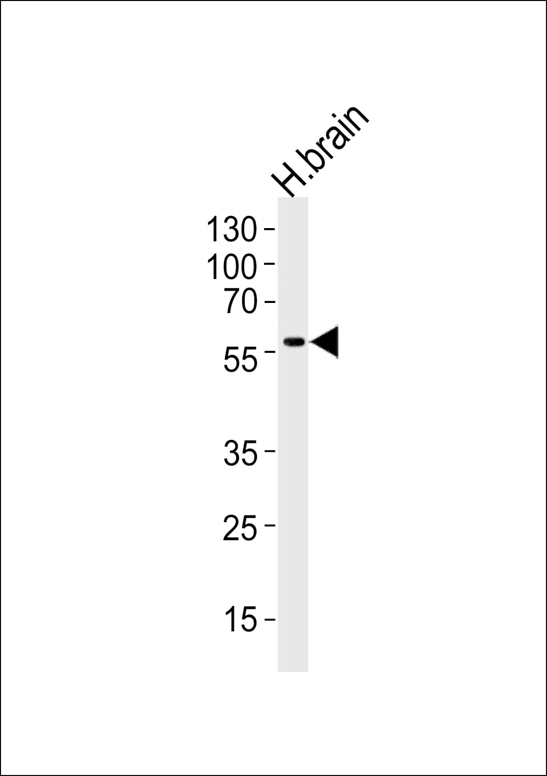 DCX / Doublecortin Antibody (Ser128)