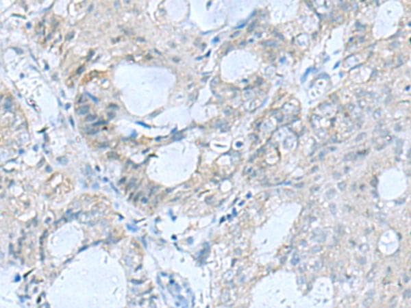 Polyclonal Rabbit anti-Human GFRA1 / GFR Alpha Antibody (IHC, WB)