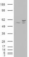 IHC-plus™ AKT3 Antibody (clone 9H8)