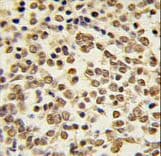 MAPK7 / ERK5 Antibody (aa776-805)