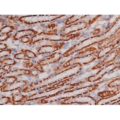Polyclonal Rabbit anti-Human MAPT / Tau Antibody (phospho-Thr181, IHC, WB)