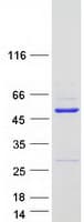 Human WDR18 Protein (Recombinant Myc-DDK (Flag))
