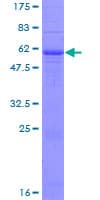 Human SPINT2 / HAI-2 Protein (Recombinant GST)