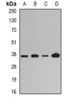Polyclonal Rabbit anti-Human LOX / Lysyl Oxidase Antibody (WB)