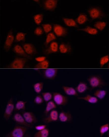 YAP / YAP1 Antibody (AP)