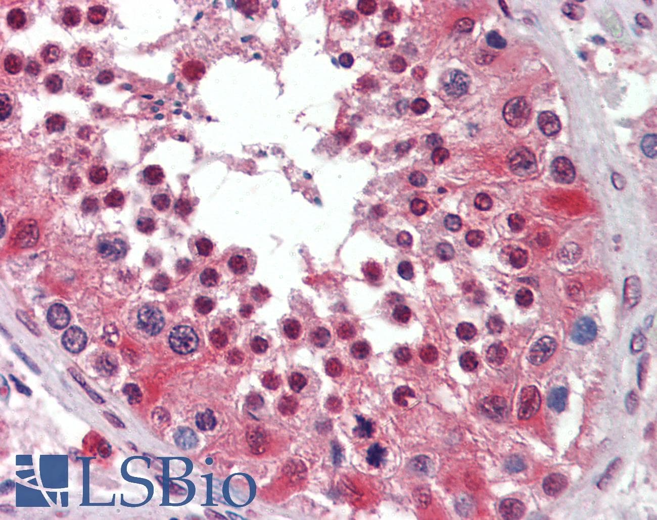 IHC-plus™ PEA3 / ETV4 Antibody (clone 1A2G3)