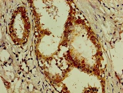 EIF3D Antibody