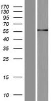 IRX6 Protein (Over-Expression Lysate Myc-DDK (Flag))