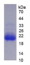 Human CYP3A7 Protein (Recombinant His)