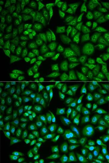 Polyclonal Rabbit anti-Human CTSA / Cathepsin A Antibody (IF)