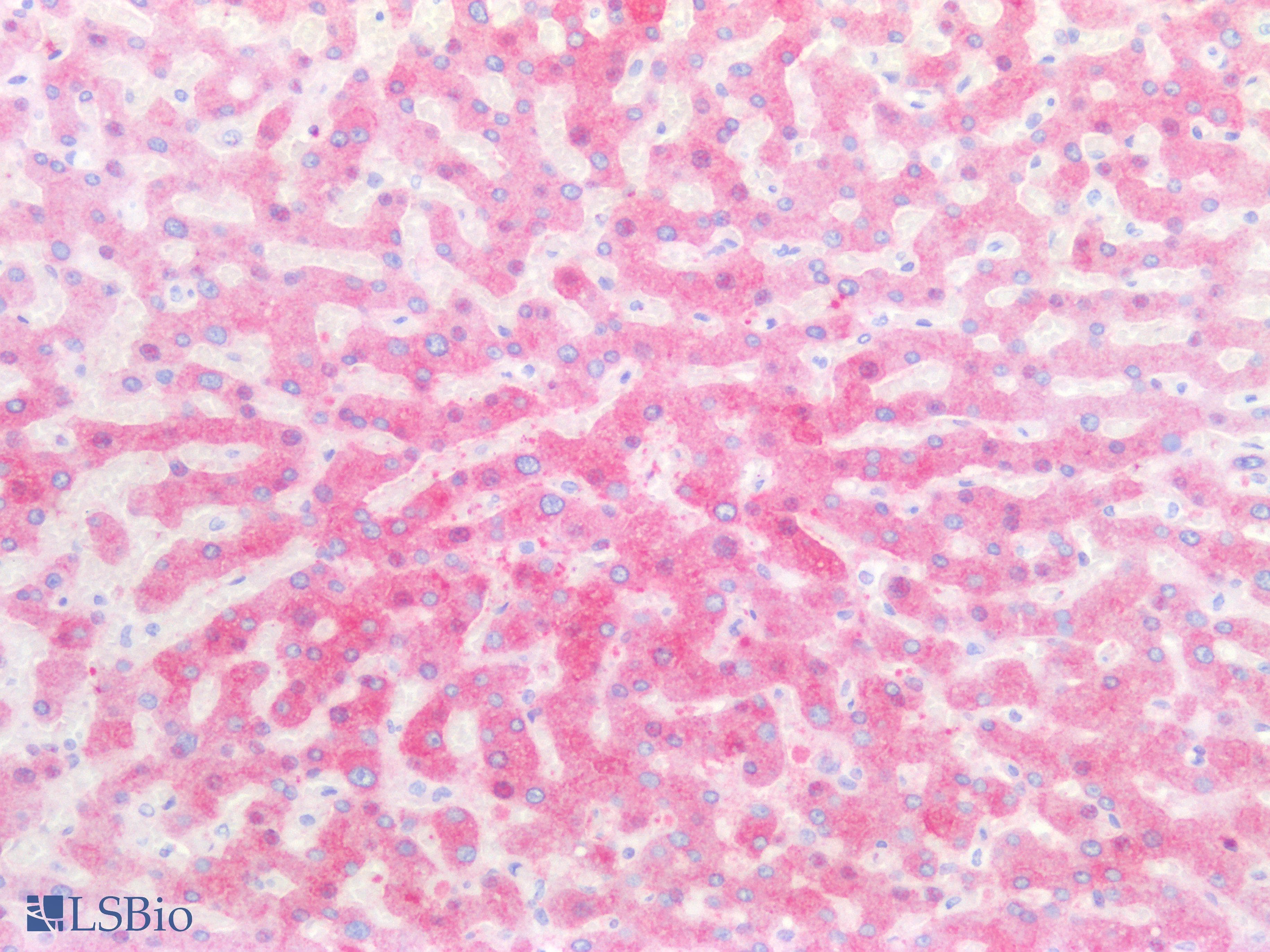 PathPlus™ Polyclonal Rabbit anti-Human EPHX1 / Epoxide Hydrolase 1 Antibody (IHC, WB)
