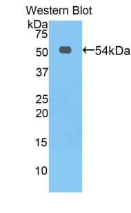 PROC / Protein C Antibody (aa197-436)