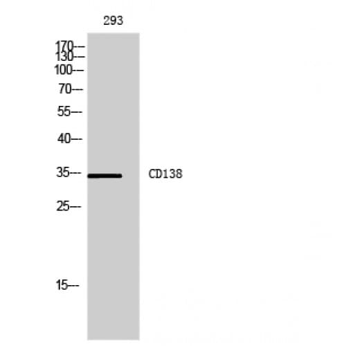 SDC1 / Syndecan 1 / CD138 Antibody (191-240 aa, Internal)