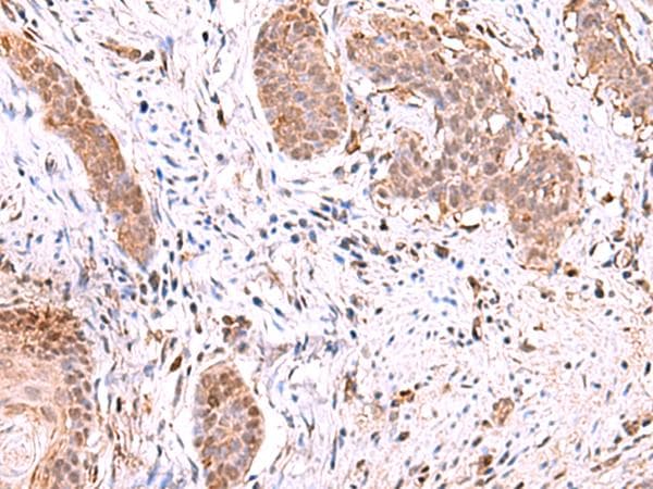 RUSC1 Antibody