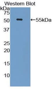 LBP Antibody (aa25-481, PE)