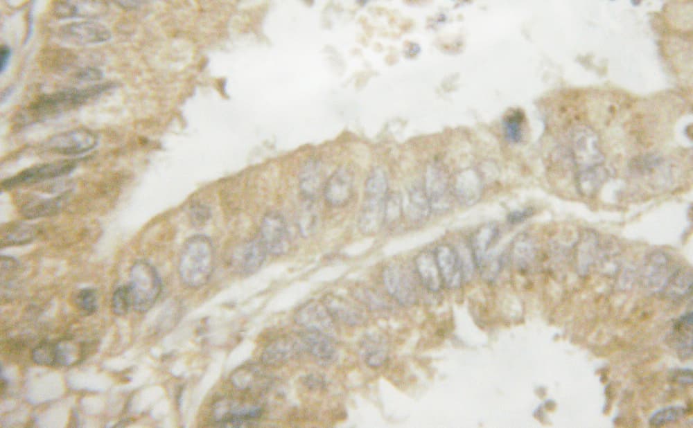 NOS3 / eNOS Antibody (phospho-Ser1177)