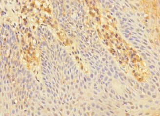 CHRNA2 Antibody