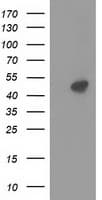 PRKAR2A Antibody (clone OTI1F8)