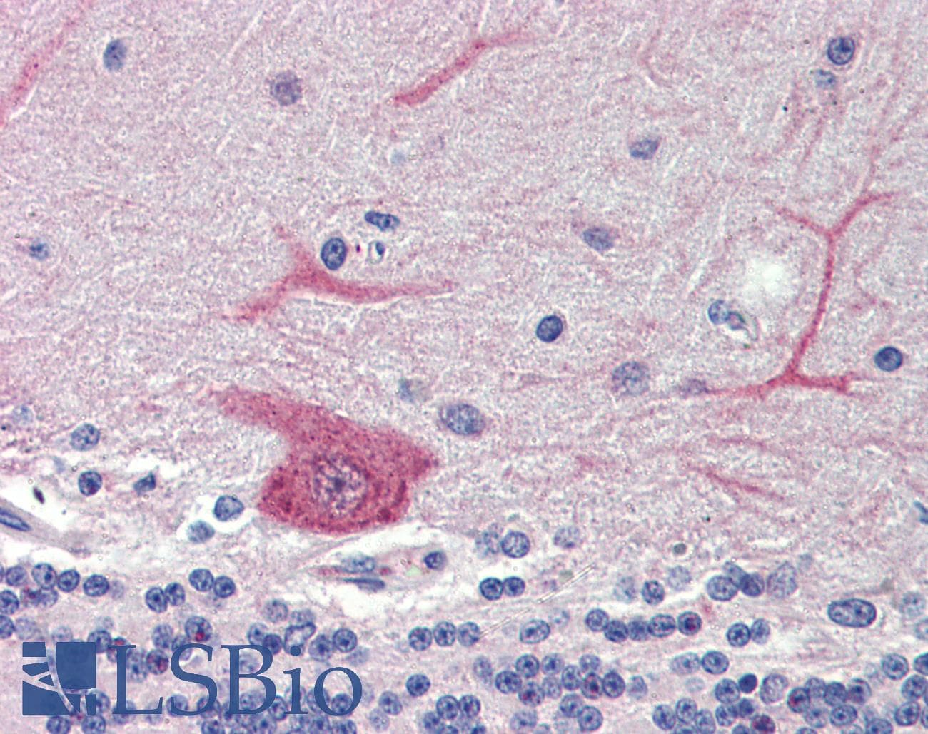 Polyclonal Rabbit anti-Human GABARAPL1 / ATG8 Antibody (N-Terminus, IHC, WB)