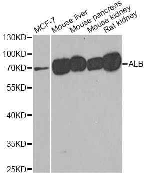 Polyclonal Rabbit anti-Human ALB / Serum Albumin Antibody (IHC, WB)