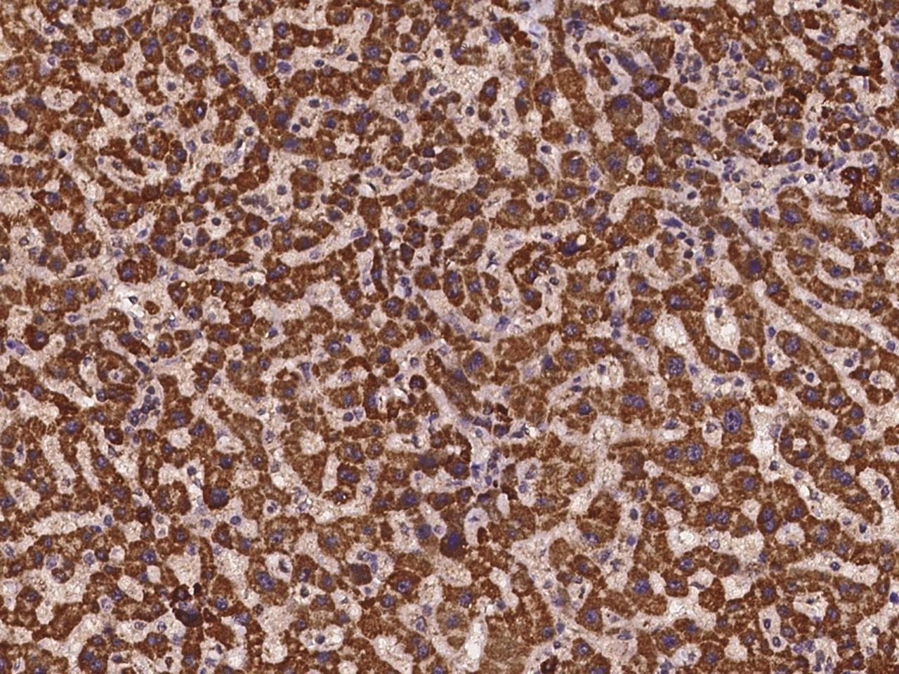 TMEM143 Antibody