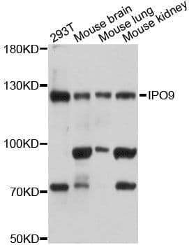 Polyclonal Rabbit anti-Human IPO9 / Importin 9 Antibody (WB)