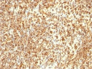 CD20 Antibody (clone L26 + IGEL/733)