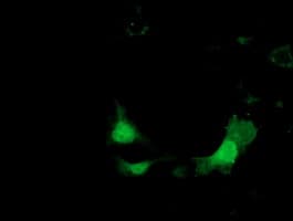 KHK / Ketohexokinase Antibody (clone OTI3D1)