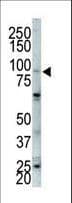 FGFR2 / FGF Receptor 2 Antibody (aa794-821)