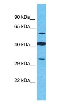 Polyclonal Rabbit anti-Human OR2M4 Antibody (aa193-242, WB)