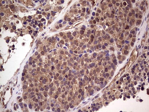 RET Antibody (aa713-1017, clone OTI5C7)
