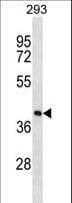FDPS Antibody (aa54-82)