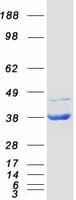 Human NUDT5 Protein (Recombinant Myc-DDK (Flag))
