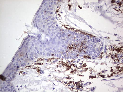 TACC2 Antibody (aa727-1026, clone OTI1C3, Carrier-free)