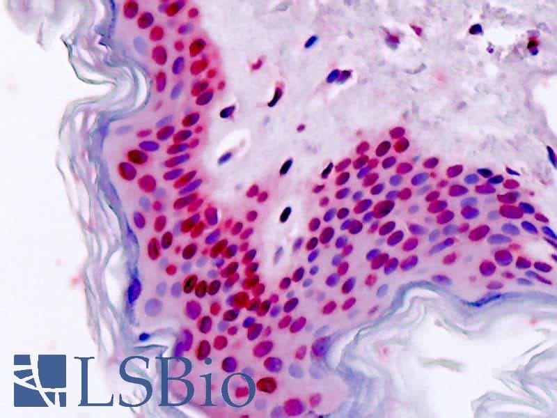 IHC-plus™ Polyclonal Rabbit anti-Rat HOXA7 Antibody (aa1-30, IHC, WB)