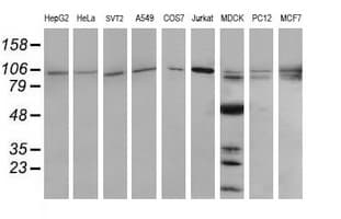 Monoclonal Mouse anti-Human PIK3R5 Antibody (clone OTI4G9, IHC, IF, WB)