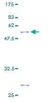 Human GSTK1 Protein (Recombinant GST)