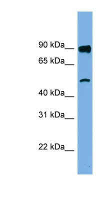 Polyclonal Rabbit anti-Human FAM160B1 Antibody (aa35-84, WB)