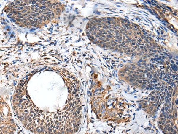 Polyclonal Rabbit anti-Human BRI3BP Antibody (IHC, WB)