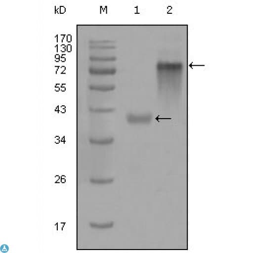 KRT19 / CK19 / Cytokeratin 19 Antibody