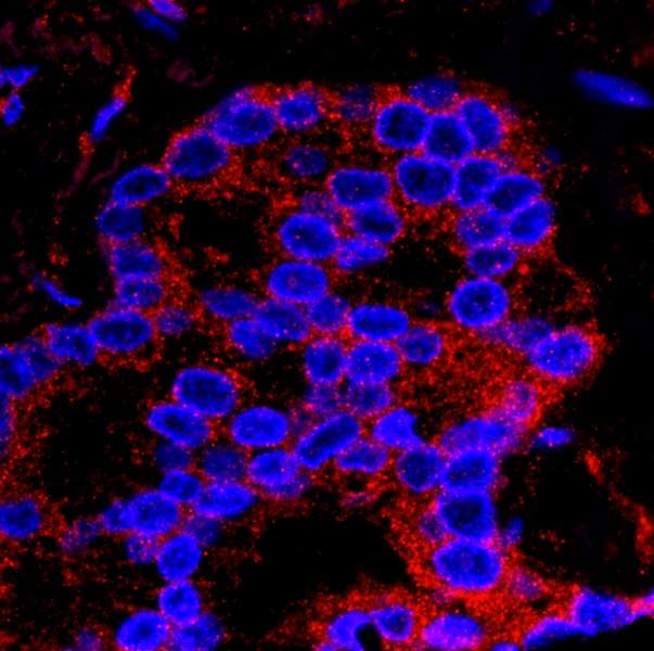 Polyclonal Rabbit anti-Human FLII / FLI Antibody (aa425-475, IHC, IF)