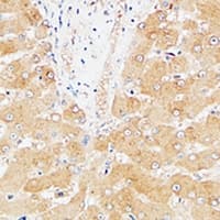 FGL1 / Hepassocin Antibody