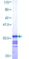Human SLC6A20 Protein (Recombinant GST, N-terminus)