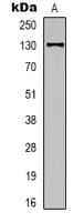 Monoclonal Mouse anti-Human NOS3 / eNOS Antibody (IHC, WB)