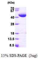 Human IVD Protein (Recombinant His)