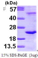 Human DR1 / NC2 Protein (Recombinant His)